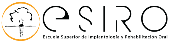 Esiro